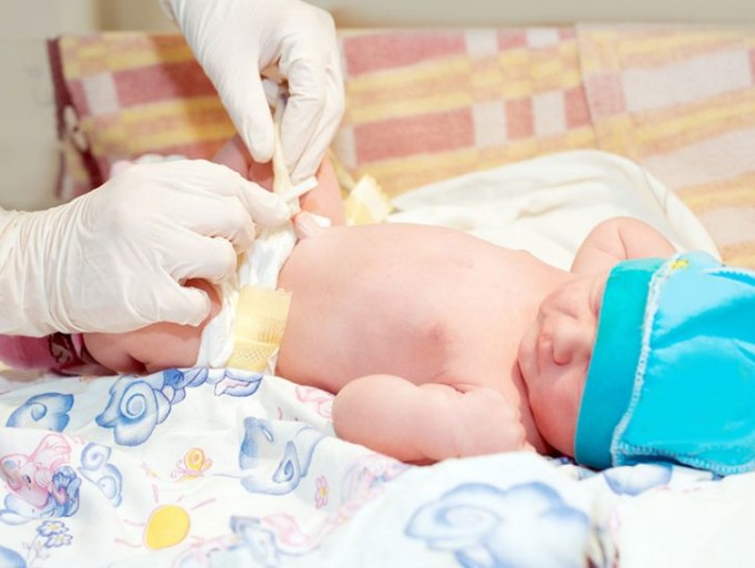 Le mani di uno specialista che raccoglie tratti del cordone ombellicale del neonato per recuperare cellule staminali Perché conservare le cellule staminali