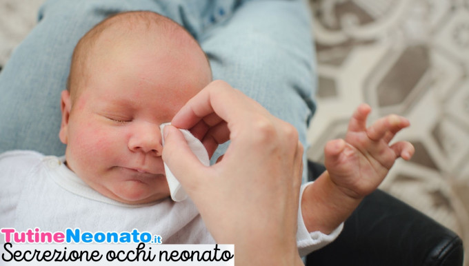 Secrezione occhi neonato 